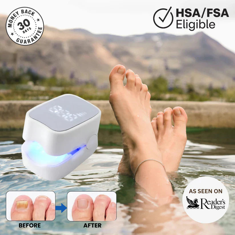 Zenorw Pro™ - Nail Fungus Laser Device